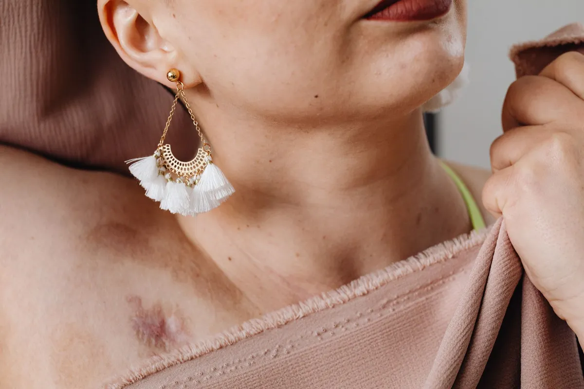Bijoux en or et allergies : ce qui provoque vraiment les réactions